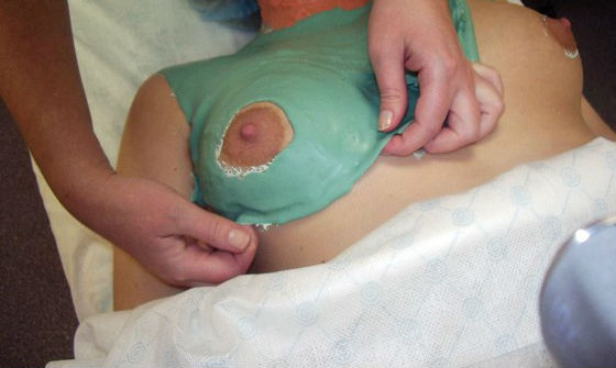 masques pour lifting des seins