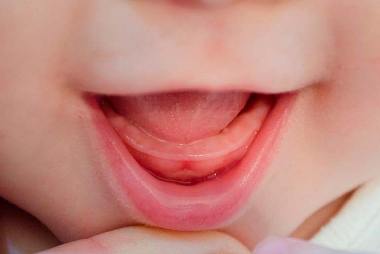 les dents de l'enfant sont coupées